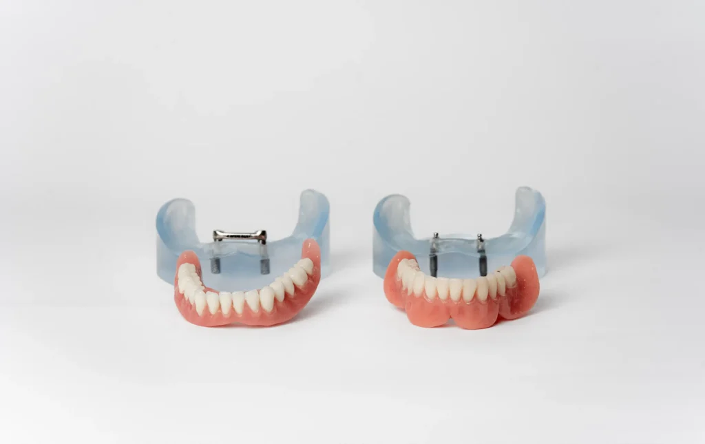Implantaten