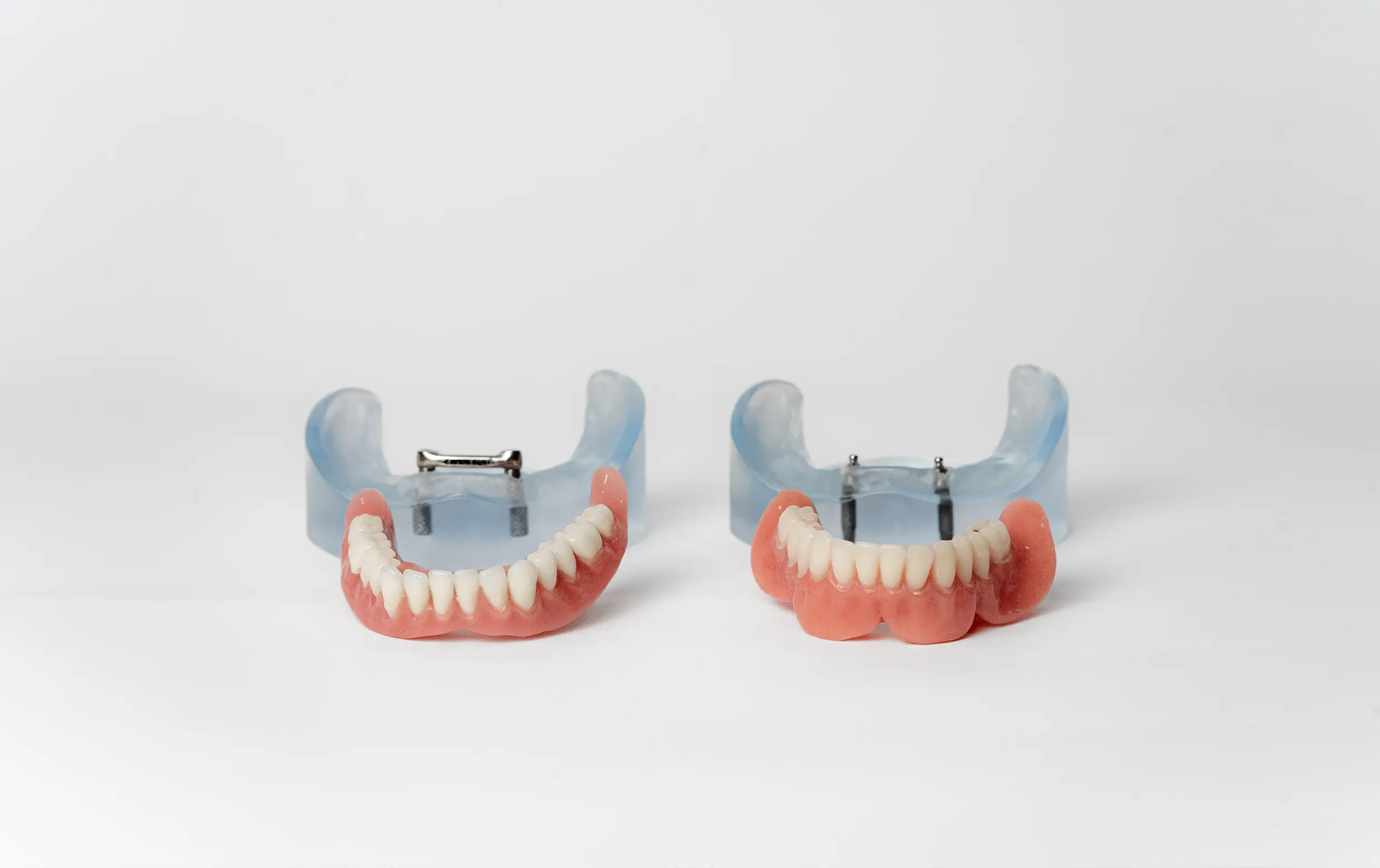 Implantaten